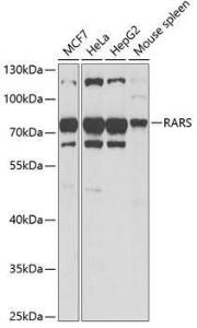 Anti-RARS antibody