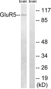 Western blot analysis of lysates from mouse brain using Anti-GluR5 Antibody. The right hand lane represents a negative control, where the antibody is blocked by the immunising peptide