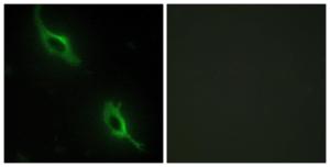 Immunofluorescence analysis of NIH/3T3 cells using Anti-CKMT2 Antibody. The right hand panel represents a negative control, where the antibody was pre-incubated with the immunising peptide