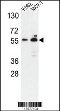 Anti-G6PD Rabbit Polyclonal Antibody