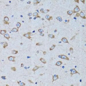 Anti-RARS antibody