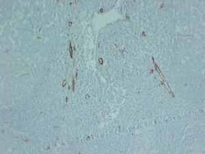 Immunohistochemical analysis of paraffin-embedded human Tonsil using Anti-CD105 Antibody