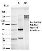 SDS-PAGE analysis of Anti-JunB Antibody [PCRP-JUNB-3G2] under non-reduced and reduced conditions; showing intact IgG and intact heavy and light chains, respectively. SDS-PAGE analysis confirms the integrity and purity of the antibody.