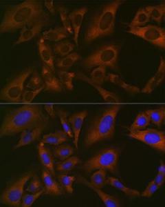 Immunofluorescence analysis of U-2 OS cells using Anti-BMP6 Antibody [ARC1025] (A305574) at a dilution of 1:100 (40X lens). DAPI was used to stain the cell nuclei (blue)