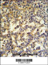 Anti-G6PD Rabbit Polyclonal Antibody