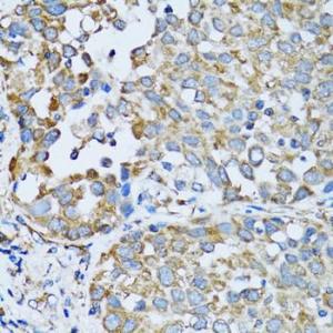 Anti-RARS antibody