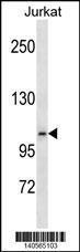 Anti-EPHB6 Rabbit Polyclonal Antibody (AP (Alkaline Phosphatase))