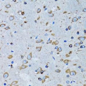 Anti-RARS antibody