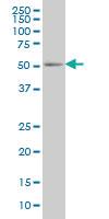 Anti-PEPD Mouse Monoclonal Antibody [clone: 1D5-H3]