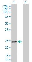 Anti-RPIA Rabbit Polyclonal Antibody