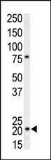 Anti-H3F3AP6 Rabbit Polyclonal Antibody