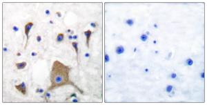 Immunohistochemical analysis of paraffin-embedded human brain tissue using Anti-GluR5 Antibody. The right hand panel represents a negative control, where the antibody was pre-incubated with the immunising peptide