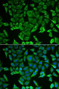 Anti-RARS antibody