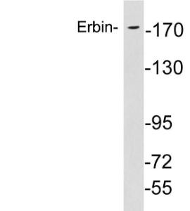 Western blot analysis of lysates from HepG2 cells using Anti-Erbin Antibody