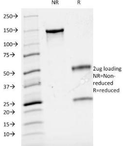 SDS-PAGE analysis of Anti-CD3 epsilon Antibody [B-B12] under non-reduced and reduced conditions; showing intact IgG and intact heavy and light chains, respectively. SDS-PAGE analysis confirms the integrity and purity of the Antibody