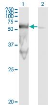 Anti-PEPD Mouse Monoclonal Antibody [clone: 1D5-H3]