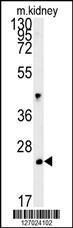 Anti-LHPL3 Rabbit Polyclonal Antibody