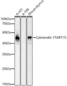 Western blot analysis of various lysates, using Anti-Cytokeratin 17 Antibody [ARC0271] (A307949) at 1:10000 dilution. The secondary Antibody was Goat Anti-Rabbit IgG H&L Antibody (HRP) at 1:10000 dilution. Lysates/proteins were present at 25 µg per lane