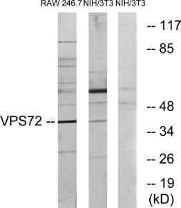 Western blot analysis of lysates from RAW264.7 and NIH/3T3 cells using Anti-VPS72 Antibody. The right hand lane represents a negative control, where the Antibody is blocked by the immunising peptide