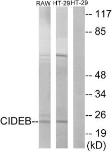 Anti-CIDE B Rabbit Polyclonal Antibody