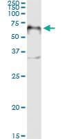 Anti-FOXA2 Antibody Pair