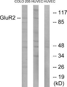 Western blot analysis of lysates from COLO205 and HUVEC cells using Anti-GluR2 Antibody. The right hand lane represents a negative control, where the antibody is blocked by the immunising peptide