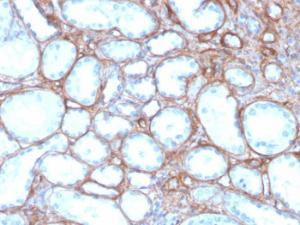 Immunohistochemical analysis of formalin-fixed, paraffin-embedded human kidney using Anti-Collagen IV Antibody [rCOL4/4742]