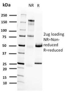 SDS-PAGE analysis of Anti-RET Antibody [RET/2662] under non-reduced and reduced conditions; showing intact IgG and intact heavy and light chains, respectively. SDS-PAGE analysis confirms the integrity and purity of the antibody.