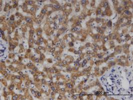 Anti-MCCC2 Mouse Monoclonal Antibody [clone: 2B3]