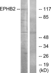 Western blot analysis of lysates from Jurkat cells using Anti-EPHB2 Antibody The right hand lane represents a negative control, where the antibody is blocked by the immunising peptide