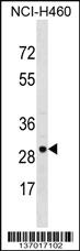 Anti-VDAC3 Rabbit Polyclonal Antibody