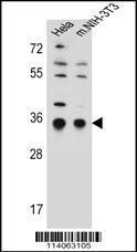 Anti-Translocon-associated Protein Subunit alpha Rabbit Polyclonal Antibody