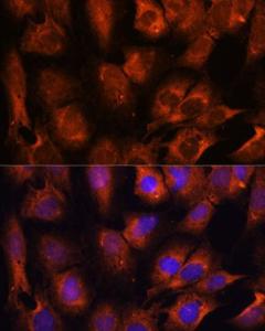 Immunofluorescence analysis of C6 cells using Anti-INPP5E Antibody (A306611) at a dilution of 1:100. DAPI was used to stain the cell nuclei (blue)