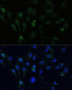 Immunofluorescence analysis of C6 cells using Anti-ZWINT Antibody (A11956) at a dilution of 1:100 (40x lens). DAPI was used to stain the cell nuclei (blue)