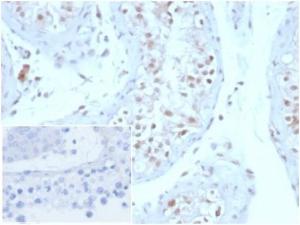 Anti-Geminin antibody