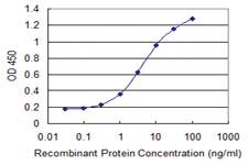 Anti-MCCC2 Mouse Monoclonal Antibody [clone: 2B3]