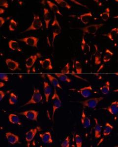 Immunofluorescence analysis of L929 cells using Anti-INPP5E Antibody (A306611) at a dilution of 1:100. DAPI was used to stain the cell nuclei (blue)