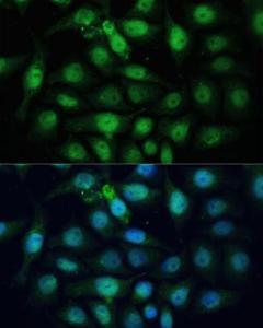 Immunofluorescence analysis of HeLa cells using Anti-ZWINT Antibody (A11956) at a dilution of 1:100 (40x lens). DAPI was used to stain the cell nuclei (blue)