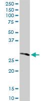 Anti-RPIA Rabbit Polyclonal Antibody