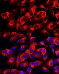 Immunofluorescence analysis of HeLa using Anti-Cytokeratin 17 Antibody [ARC0271] (A307949) at a dilution of 1:100 (40X lens). DAPI was used to stain the cell nuclei (blue)