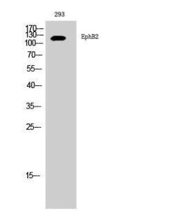 Western blot analysis of 293 cells using Anti-EPHB2 Antibody