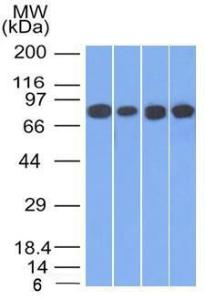 Western blot analysis of HT20, A549, 293, and A431 cell lysates using Anti-gamma Catenin Antibody [11E4]