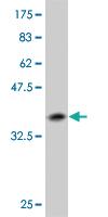 Anti-HEY1 Mouse Monoclonal Antibody [clone: 3G10]