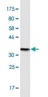 Anti-TNFRSF25 Mouse Monoclonal Antibody [clone: 1H2]