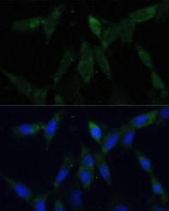 Immunofluorescence analysis of NIH-3T3 cells using Anti-ZWINT Antibody (A11956) at a dilution of 1:100 (40x lens). DAPI was used to stain the cell nuclei (blue)