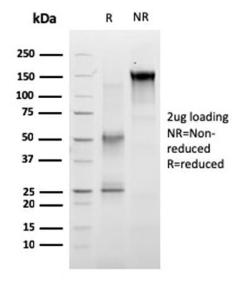 SDS-PAGE analysis of Anti-RET Antibody [RET/2663] under non-reduced and reduced conditions; showing intact IgG and intact heavy and light chains, respectively. SDS-PAGE analysis confirms the integrity and purity of the antibody.