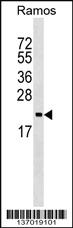 Anti-ARF5 Rabbit Polyclonal Antibody