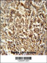 Anti-DIS3 Rabbit Polyclonal Antibody (HRP (Horseradish Peroxidase))