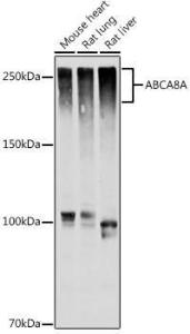 Western blot analysis of extracts of various cell lines, using Anti-Abca8a Antibody (A306614) at 1:1000 dilution. The secondary Antibody was Goat Anti-Rabbit IgG H&L Antibody (HRP) at 1:10000 dilution. Lysates/proteins were present at 25 µg per lane