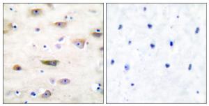 Immunohistochemical analysis of paraffin-embedded human brain tissue using Anti-GluR2 Antibody. The right hand panel represents a negative control, where the antibody was pre-incubated with the immunising peptide